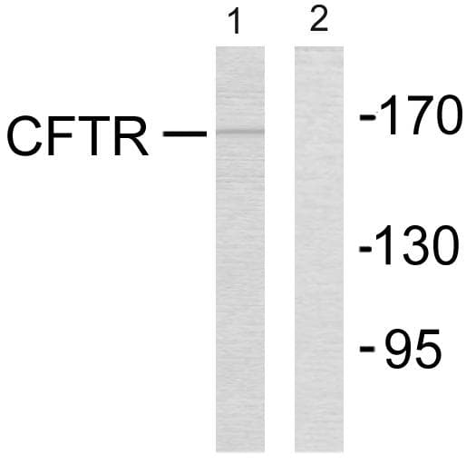 CFTR Antibody (p737)