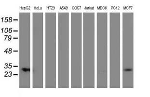 Monoclonal Mouse anti-Human SULT1A1 / Sulfotransferase 1A1 Antibody (clone OTI5F1, IHC, IF, WB)