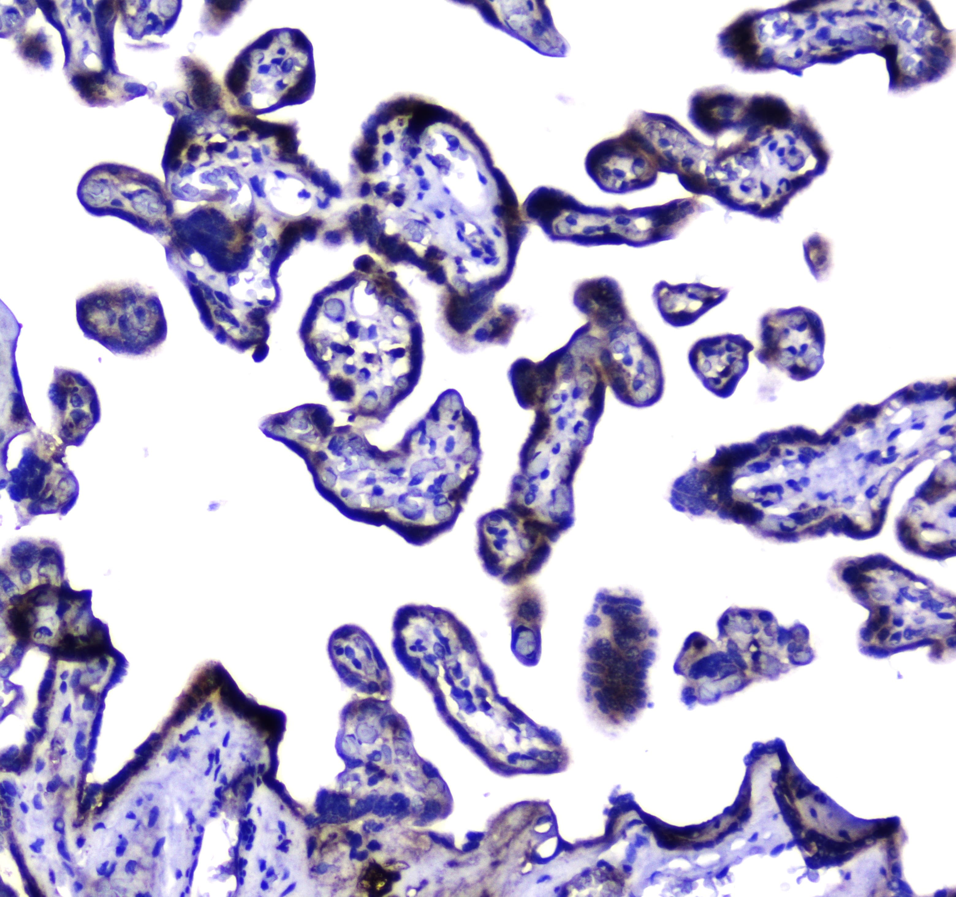 Polyclonal Rabbit anti-Human MAC-2-BP / LGALS3BP Antibody (IHC, WB)