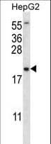 UBE2NL Antibody (aa6-34)