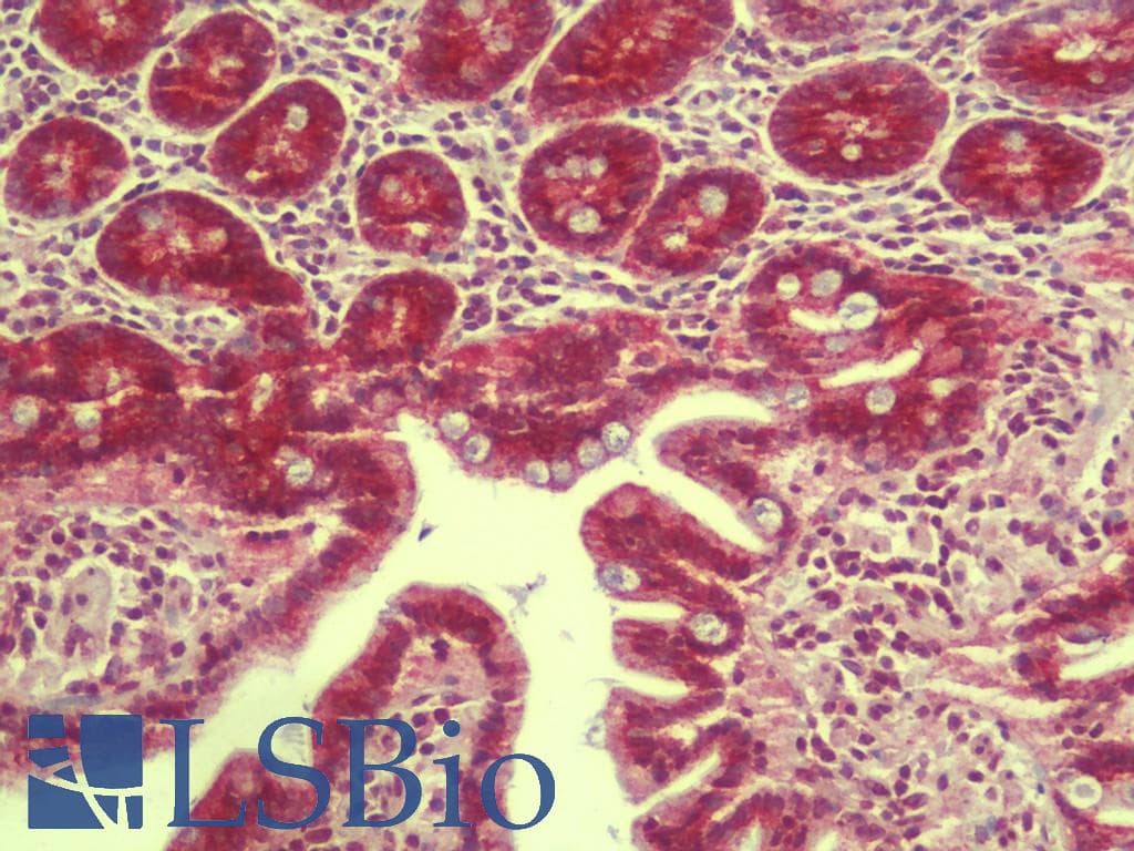 IHC-plus™ RILPL1 Antibody