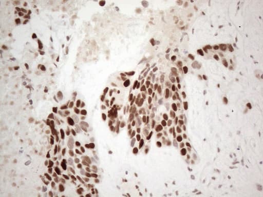 TDG / Thymine DNA Glycosylase Antibody (aa160-253, clone OTI3C11)