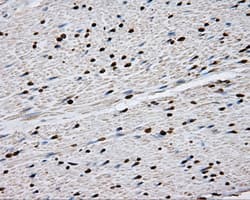 DAPK2 / DAP Kinase 2 Antibody (clone OTI1C5, Carrier-free)