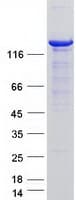 Human USP8 / UBPY Protein (Recombinant Myc-DDK (Flag))