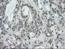 STK39 / SPAK Antibody (clone OTI3C12)