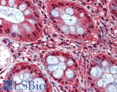 IHC-plus™ Polyclonal Rabbit anti-Human PSMB8 / LMP7 Antibody (IHC, IF, WB)