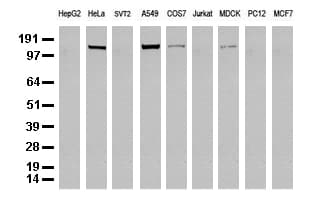 Monoclonal Mouse anti-Human EGFR Antibody (clone UMAB95, Carrier-free, IHC, IF, WB)