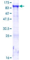 Human MTMR8 Protein (Recombinant GST)