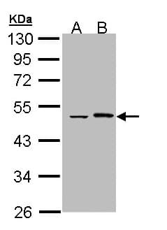 EPHX1 / Epoxide Hydrolase 1 Antibody (aa1-223)