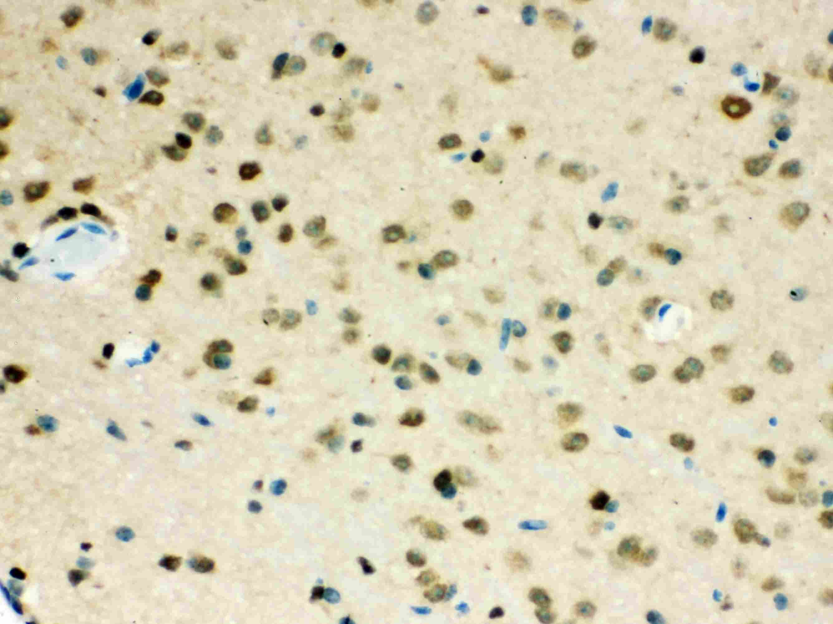 Polyclonal Rabbit anti-Human VCP Antibody (IHC, WB)
