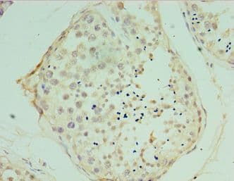 Polyclonal Rabbit anti-Human VAMP2 / VAMP-2 Antibody (aa1-94, IHC)