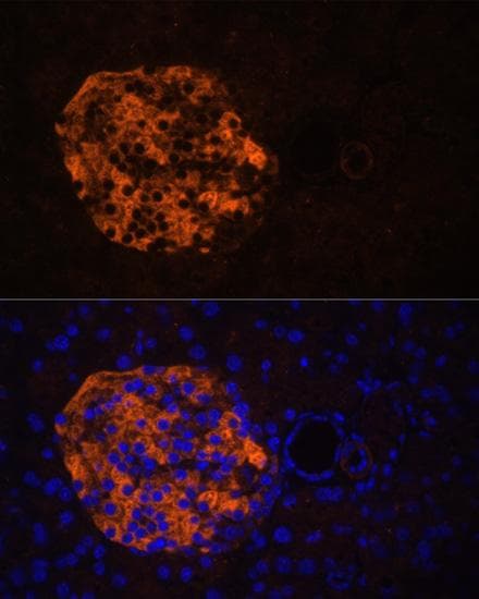 PNLIPRP2 Antibody