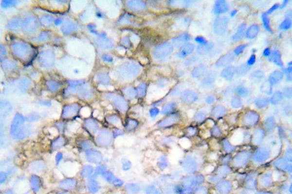 Polyclonal Rabbit anti-Human HSPB1 / HSP27 Antibody (phospho-Ser78/Ser82, IHC)