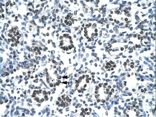 Polyclonal Rabbit anti-Human HOXB9 Antibody (aa67-116, IHC, WB)