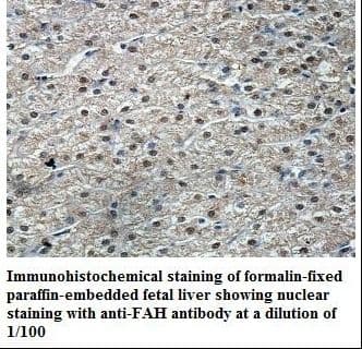 Polyclonal Rabbit anti-Human FAH Antibody (aa236-408, IHC, WB)
