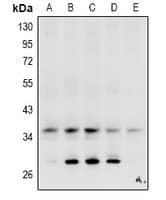 Polyclonal Rabbit anti-Human CA4 / Carbonic Anhydrase IV Antibody (WB)