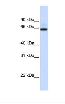 UGT1A7 Antibody (aa74-123)