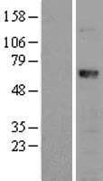 RUNX1T1 / ETO Protein (Over-Expression Lysate Myc-DDK (Flag))