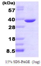 Human AKR1B1 / Aldose Reductase Protein (Recombinant)