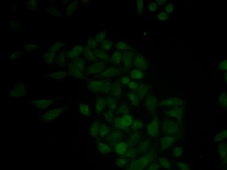 Polyclonal Rabbit anti-Human CTSE / Cathepsin E Antibody (IHC, IF, WB)