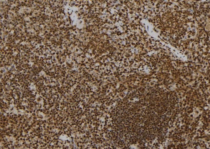 PRNP / PrP / Prion Antibody