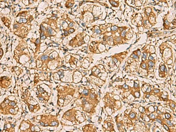 AIMP1 / EMAP II Antibody