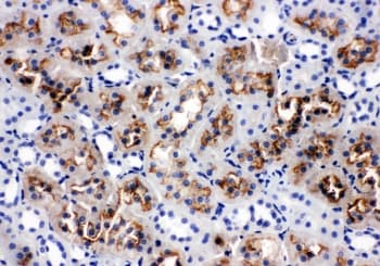 AQP1 / Aquaporin 1 Antibody (aa251-269)