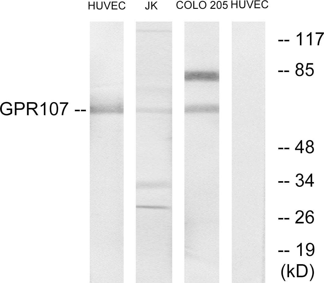 GPR107 / LUSTR1 Antibody