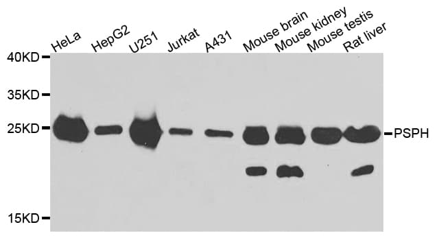 PSPH Antibody
