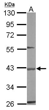 Polyclonal Rabbit anti-Human BBOX1 / BBOX Antibody (aa1-293, IHC, WB)
