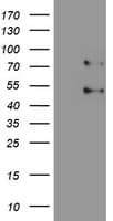 SENP1 Antibody (clone OTI1D7)