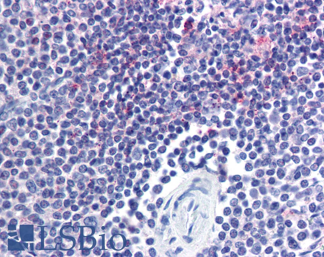 IHC-plus™ Monoclonal Mouse anti-Human BRIP1 / BACH1 Antibody (clone pp15-IB4, IHC, WB)