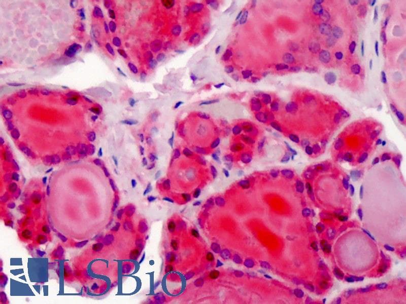 IHC-plus™ XPO1 / CRM1 Antibody (aa390-408)