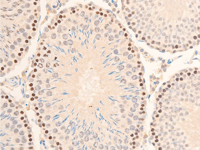 Polyclonal Rabbit anti-Human NFKBIA / IKB Alpha / IKBA Antibody (phospho-Ser32,phospho-Ser36, IHC, IF, WB)