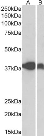 IHC-plus™ Polyclonal Goat anti-Human IDH3A Antibody (aa353-366, IHC, WB)
