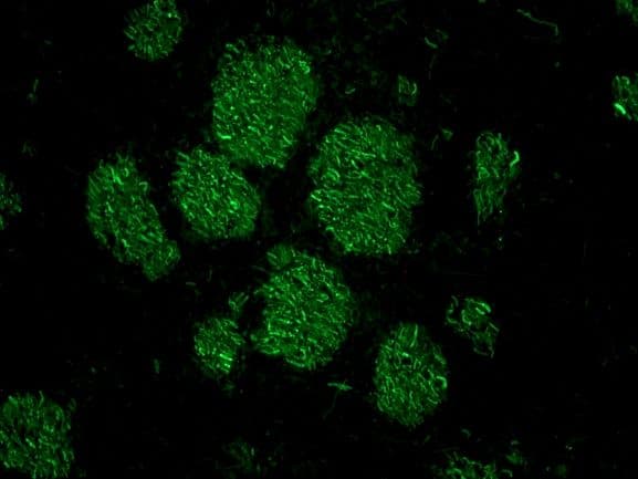 PathPlus™ NEFM / NF-M Antibody (clone RNF406)