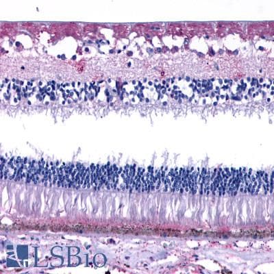 PathPlus™ GPR50 Antibody (Cytoplasmic Domain)