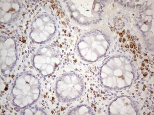 Monoclonal Mouse anti-Human DJ858B16.2 / PISD Antibody (clone OTI4G5, aa80-340, IHC, WB)