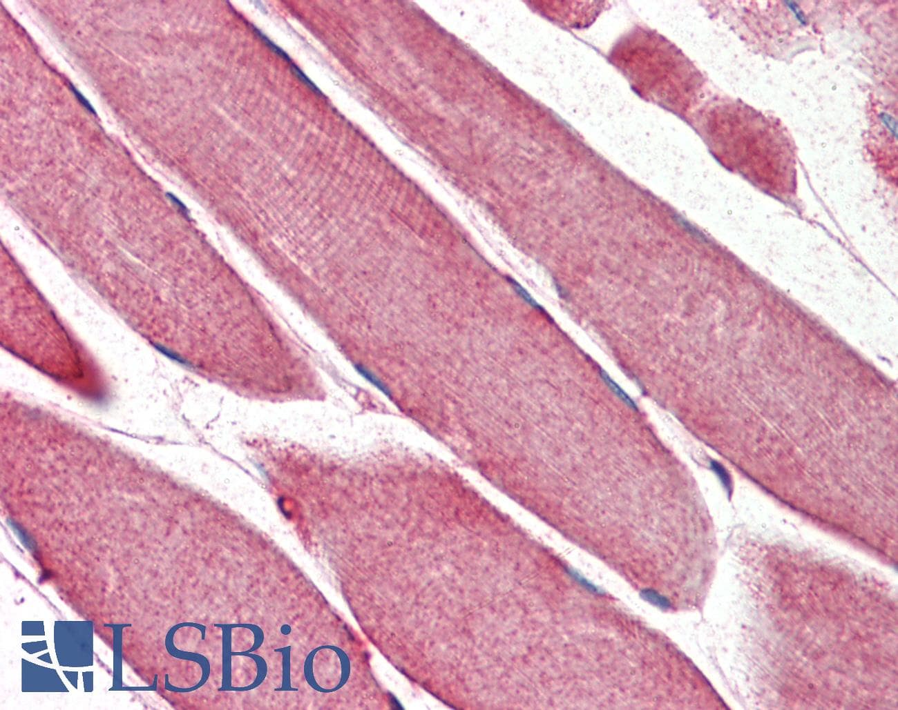 IHC-plus™ TRIM11 Antibody (Internal Region)