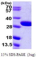 E. coli glsA1 / Glutaminase 1 Protein (Recombinant His)
