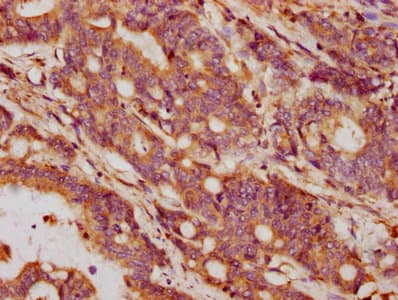 GDF5 / GDF-5 Antibody (aa202-501)