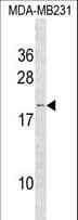 Polyclonal Rabbit anti-Human IFNA6 / Interferon Alpha 6 Antibody (aa163-189, WB)