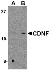 IHC-plus™ CDNF / ARMETL1 Antibody