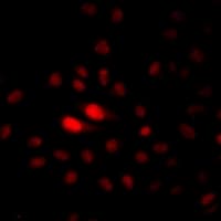 Polyclonal Rabbit anti-Human NAT10 Antibody (IF, WB)