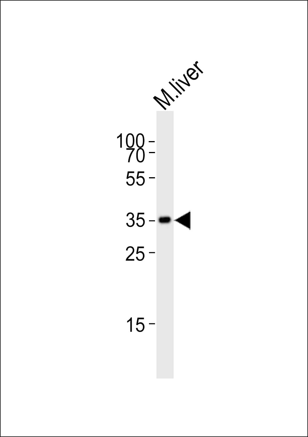 HMX2 Antibody (aa149-180)