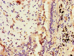 Polyclonal Rabbit anti-Human STAT2 Antibody (IHC, IF)