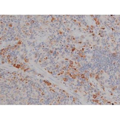 MAPT / Tau Antibody (phospho-Thr231)