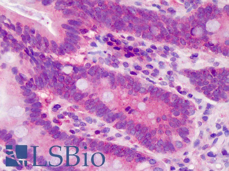 POLDIP3 / p46 Antibody (aa326-375)