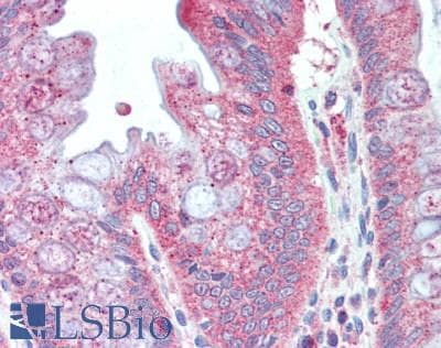 IHC-plus™ VIPERIN / RSAD2 Antibody (aa42-361)