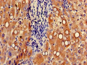 Polyclonal Rabbit anti-Human UGT1A9 Antibody (IHC, IF)